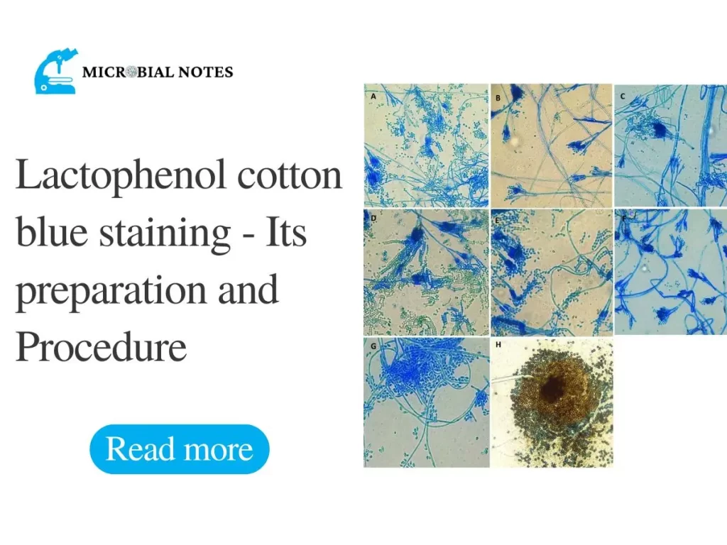 Lactophenol cotton blue staining