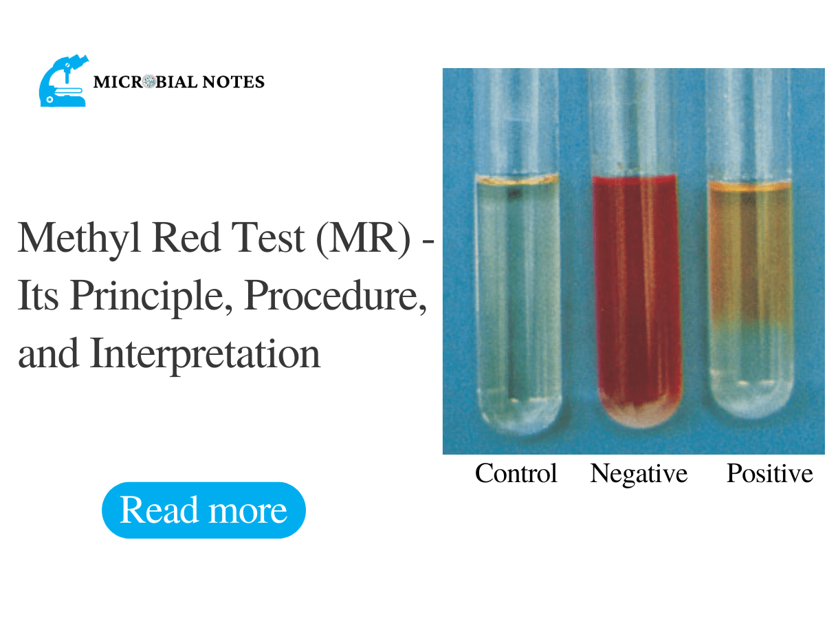 Oxidative fermentative (OF) test: Principle, Procedure, Results