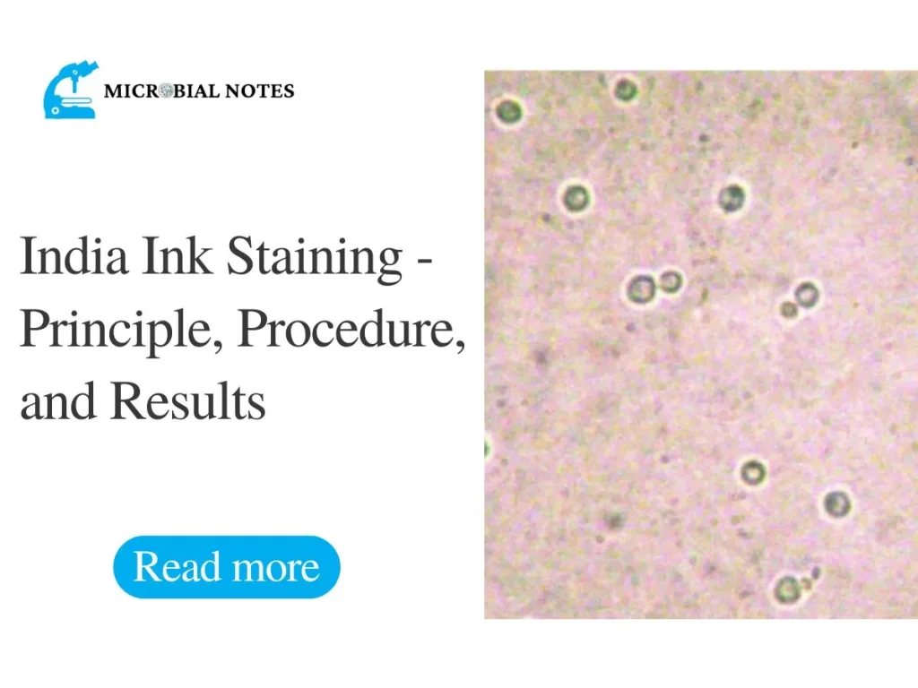 India Ink Staining - Principle, Procedure, and Results