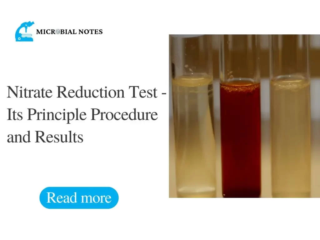 nitrate reduction test