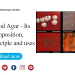 blood agar
