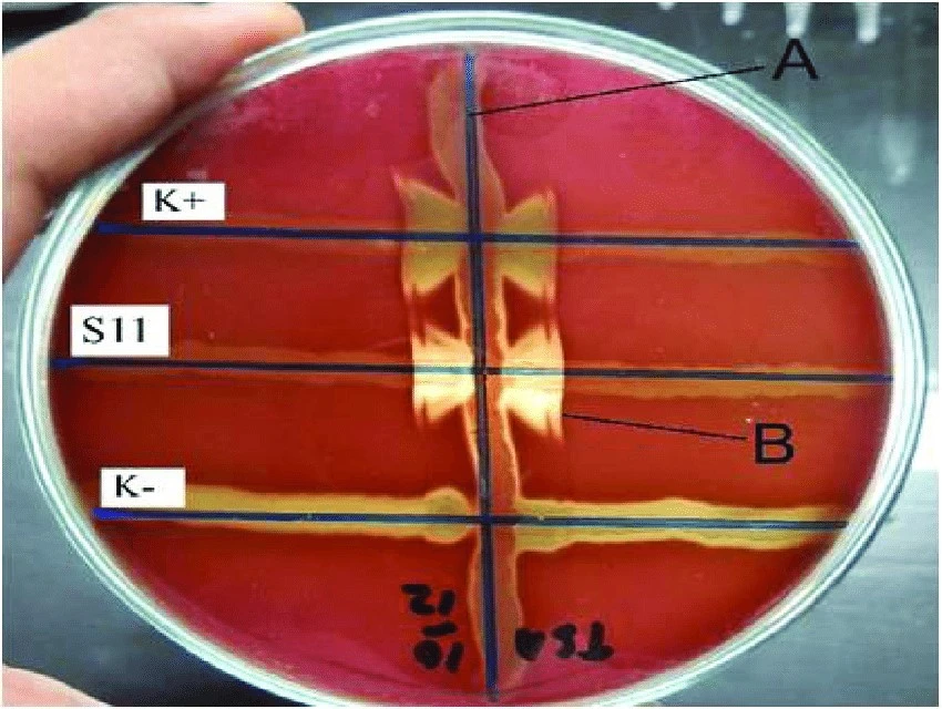 CAMP test showing half-moon shaped zone of complete hemolysis on a