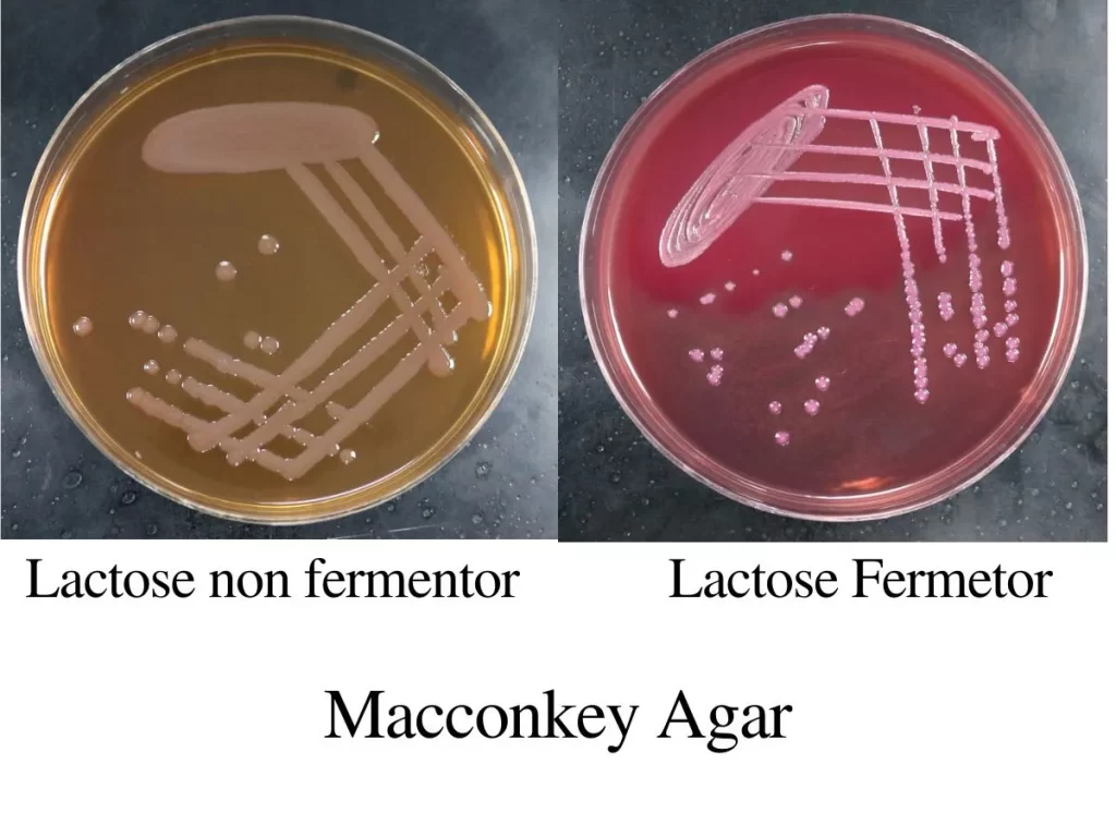 macconkey agar results