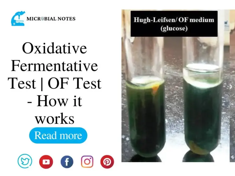 Oxidative Fermentative Test