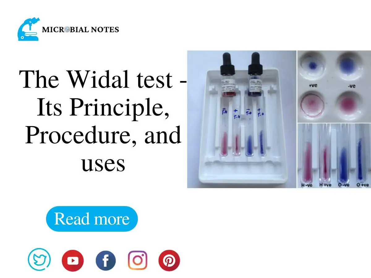 The Widal Test Its Principle Procedure And Uses 9057