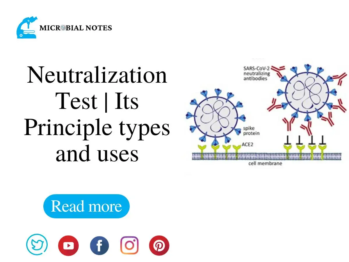 Neutralization Test Its Principle Types And Uses 7488