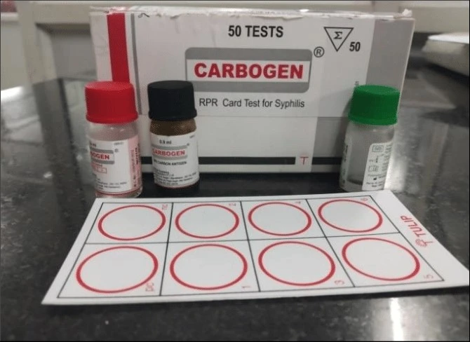 prp test kit