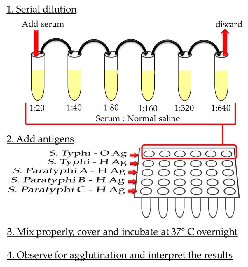 basic method of widal test