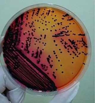 Salmonella typhi on XLD agar